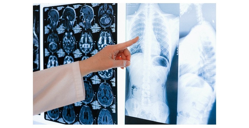 BPCO e insufficienza cardiaca